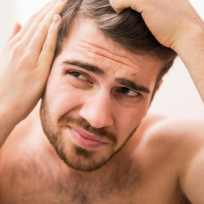 Early Symptoms and Treatment of Male Pattern Baldness