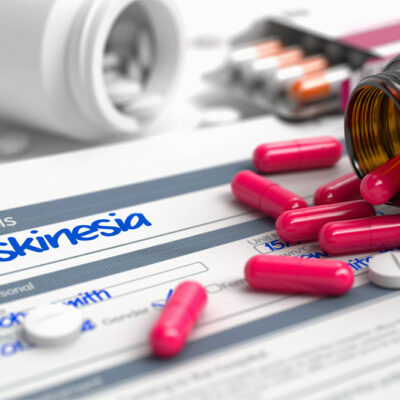 Identifying the Right Treatment for Dyskinesia