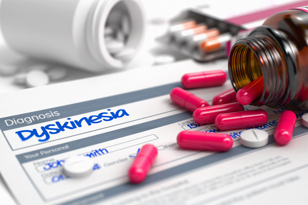 Identifying the Right Treatment for Dyskinesia