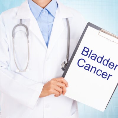 Signs and Symptoms of Bladder Cancer