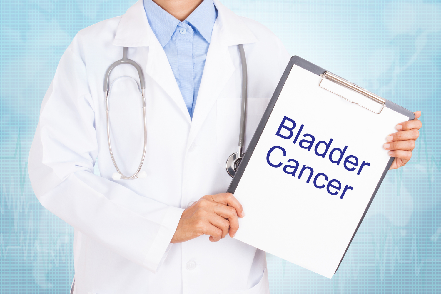 Signs and Symptoms of Bladder Cancer