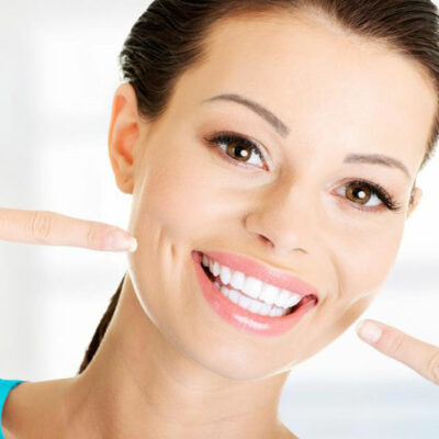 Teeth Whitening Solutions and Products for Smokers