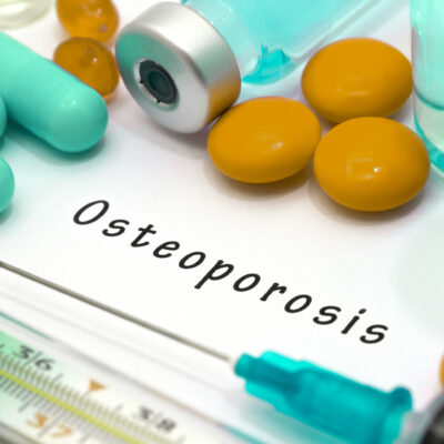 Treatment Options for Osteoporosis